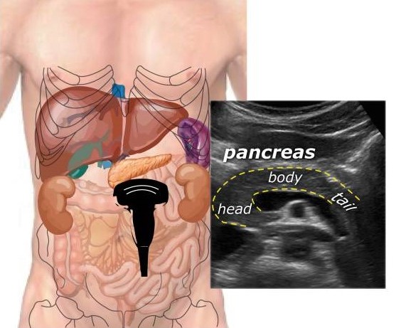 Hasnyálmirigy Hasnyálmirigy