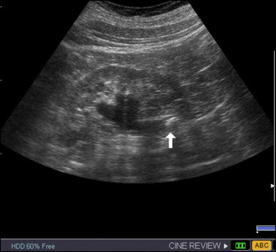 Hugyvezetek-ko Hugyvezetek-ko